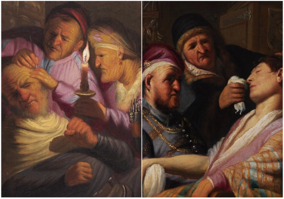 Links: De operatie (het gevoel), ca. 1624, olieverf op paneel, The Leiden Collection, New York. Rechts: De flauwgevallen patiënt (de reuk), ca. 1624, olieverf op paneel, The Leiden Collection, New York.